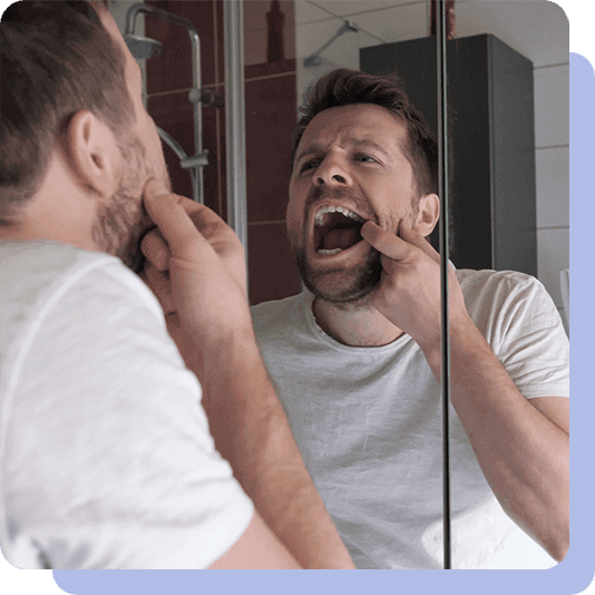 Man doing mouth cancer check at home